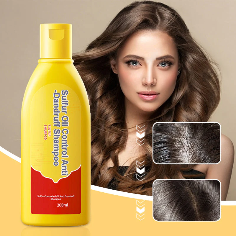 Sulfur Oil Control Anti-Dandruff Shampoo
